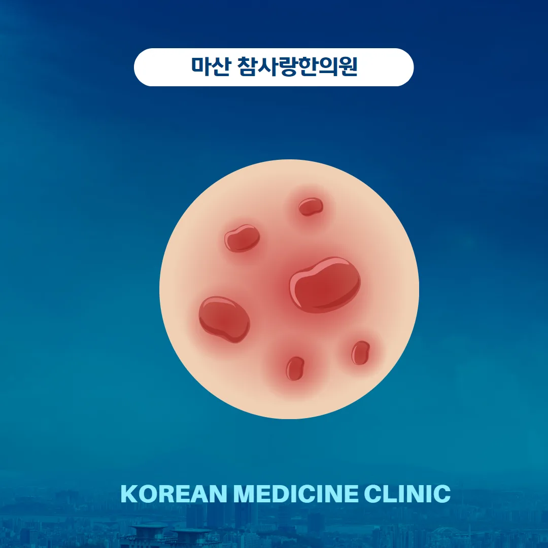 1. 두드러기의 정의