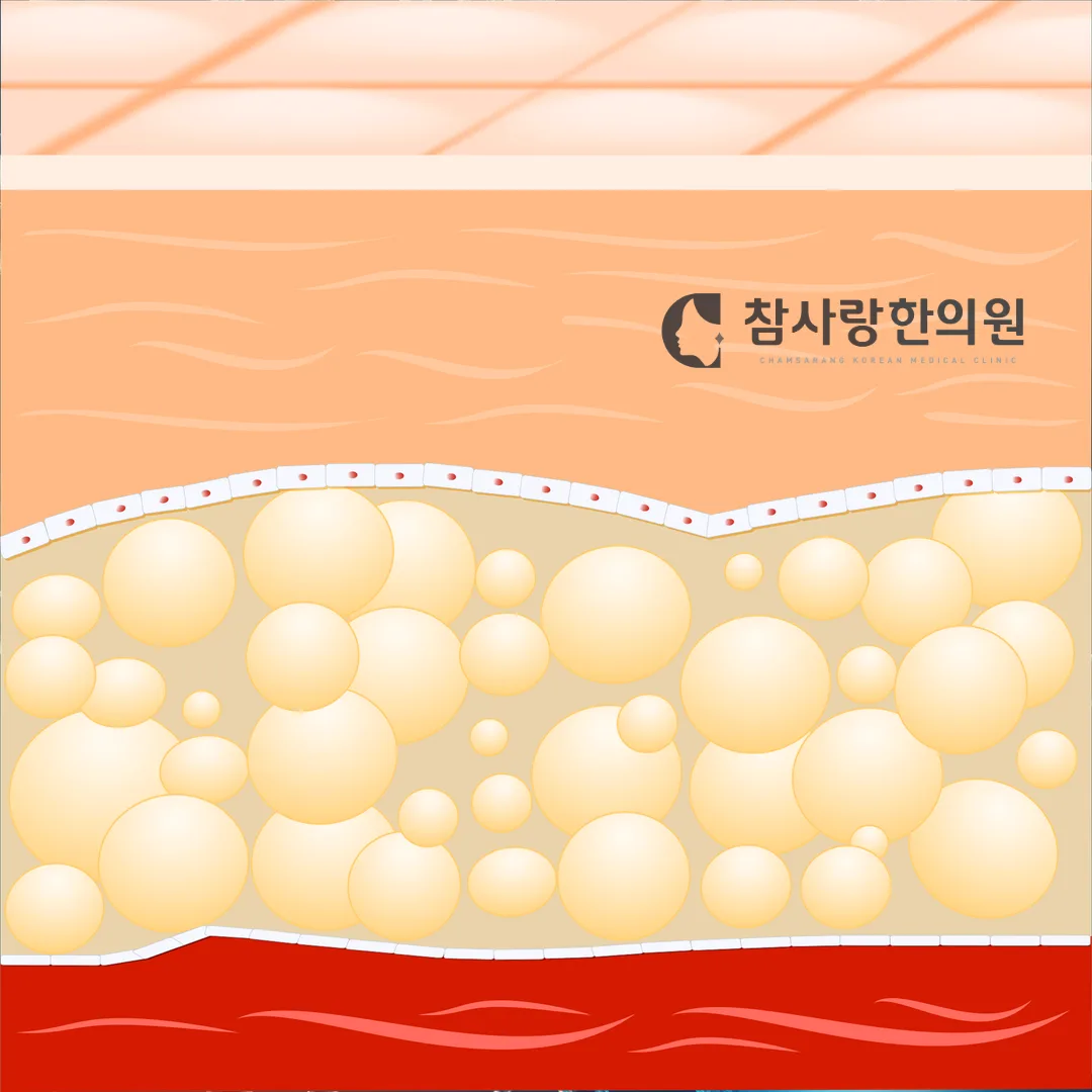 4. 마산에서 안면홍조 한의학적으로 치료하려면?