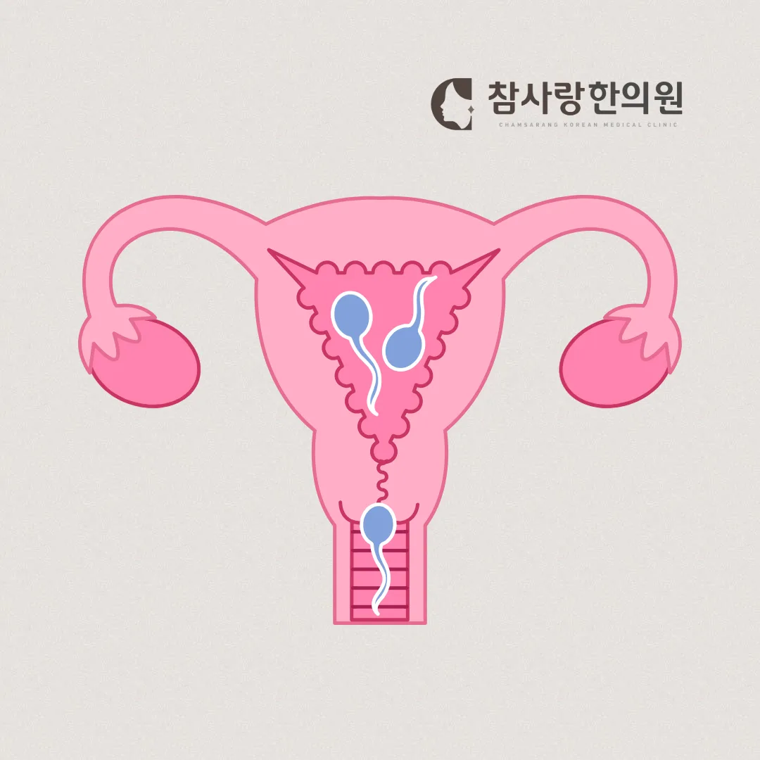 자궁근종, 수술 없이 관리할 수 있을까? 한의학적 치료법 공개