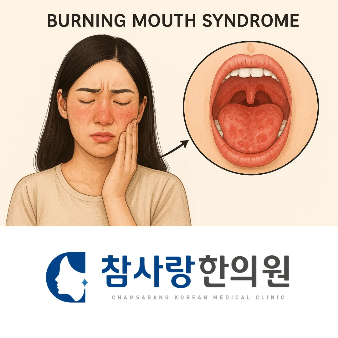 Q. 구내염도 침 치료가 도움이 되나요?