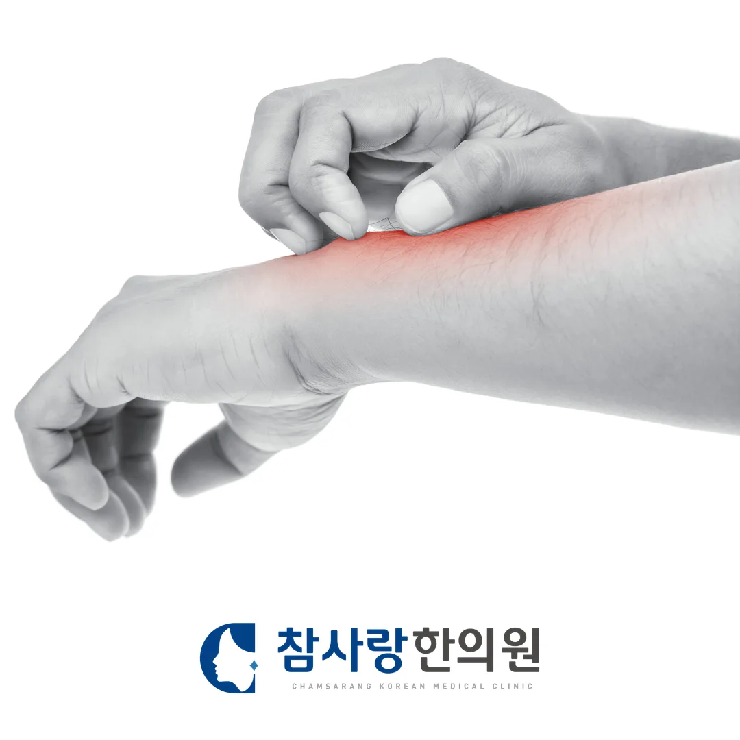 마산 가려움증, 피부는 멀쩡한데 계속 간지러운 이유는?