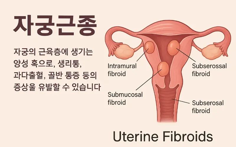 지속되는 생리통과 과다출혈, 혹시 자궁근종? 마산 한의원에서 살펴보는 해결책