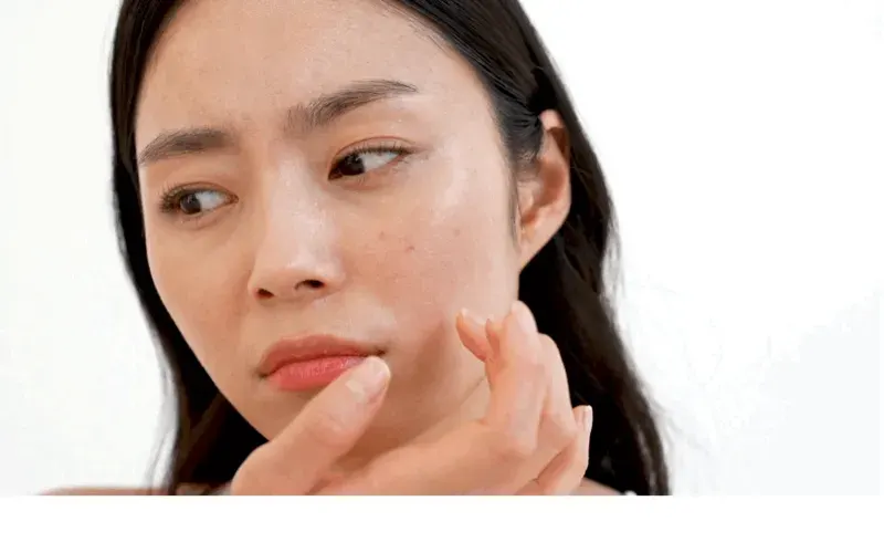 계속되는 화끈거림과 붉은기… 혹시 마산 주사피부염?