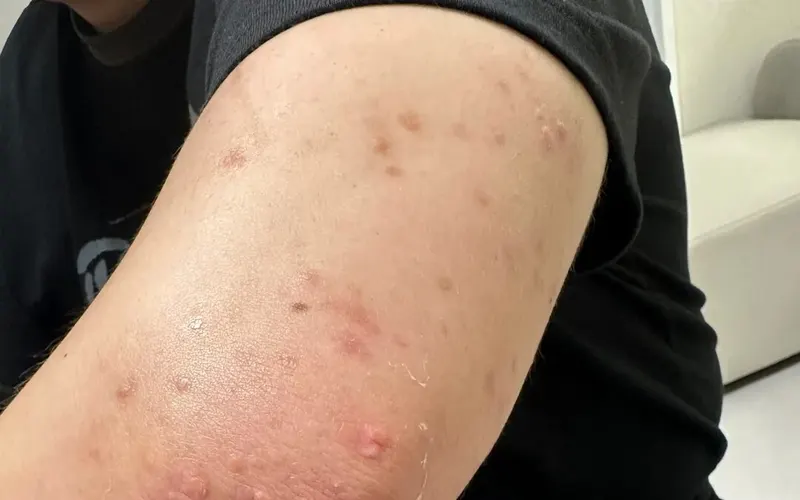 창원 건선 · 마산 건선, 피부가 보내는 신호를 무시하지 마세요