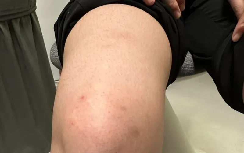“마산 피부염, 왜 나만 반복될까요? – 한의학에서 원인을 찾다”