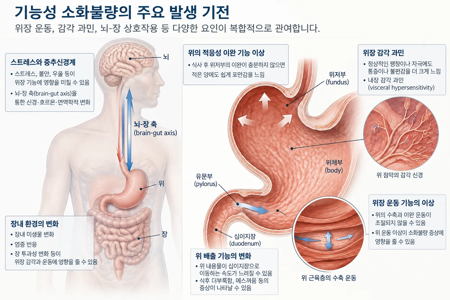 masan-dyspepsia-clinic-functional-dyspepsia-causes