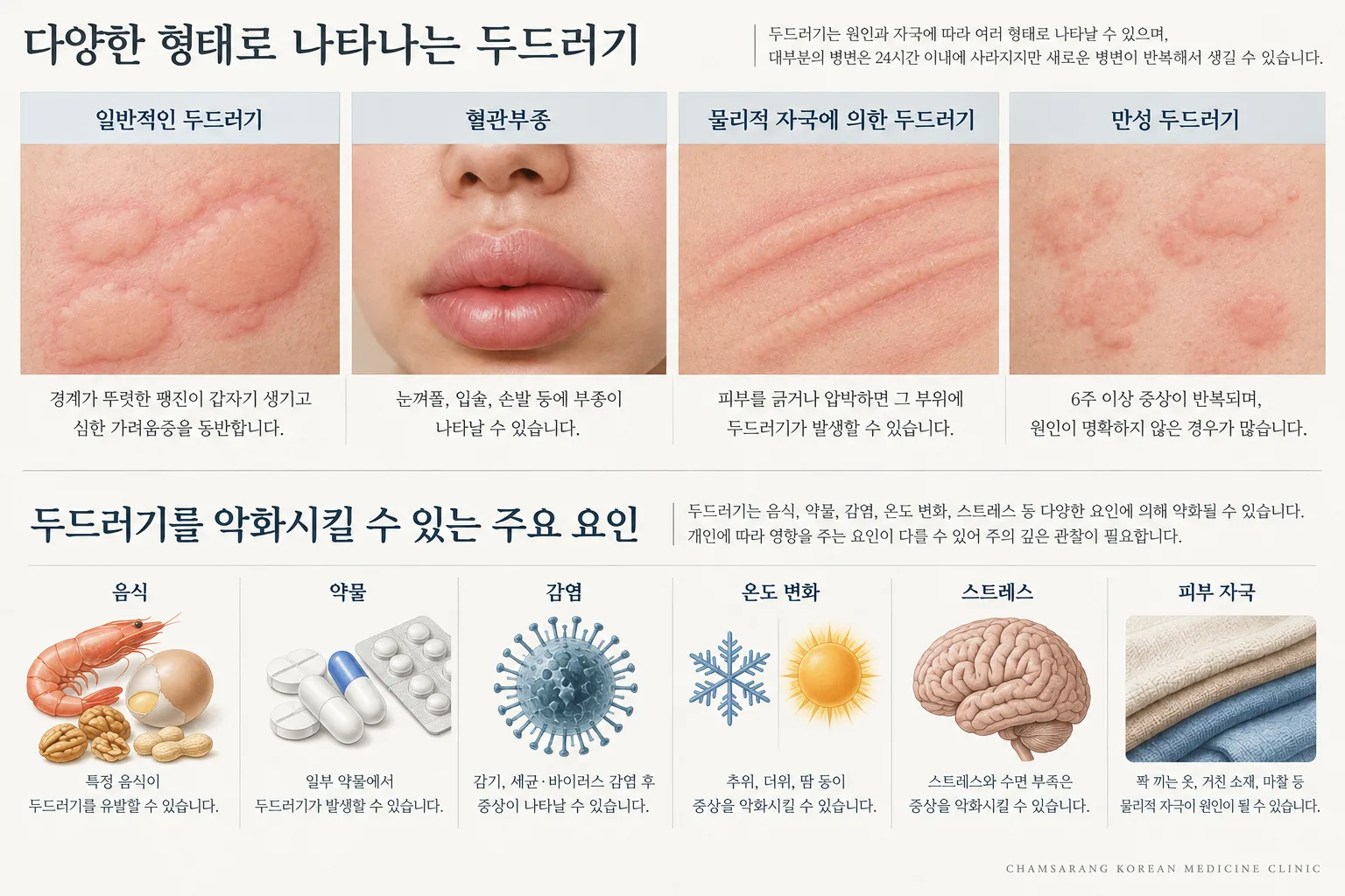changwon-urticaria-types-causes-infographic